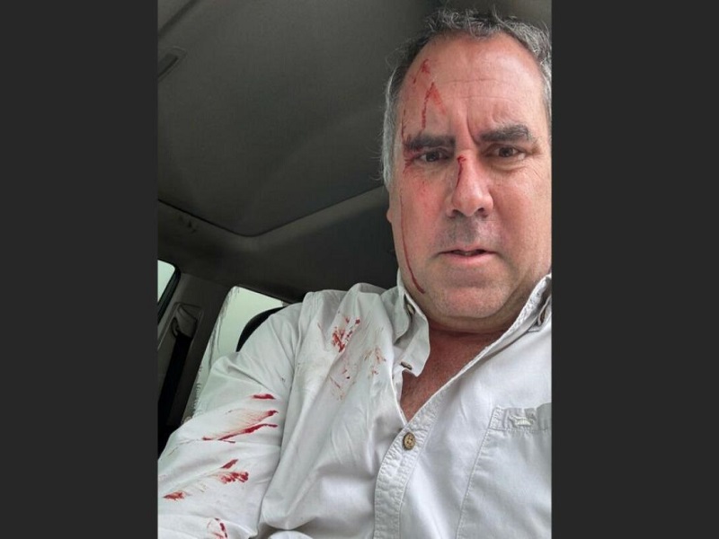 Rafael Belaunde tras ataque en su contra: "No considero más que un milagro que solo tenga unos raspones"